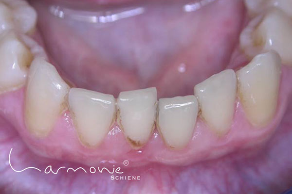 Bild Engstand / © Orthos Bild Engstand / © Orthos